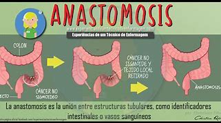 Image result for anastomosis