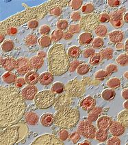 Image result for Bacterium Chlamydia Trachomatis