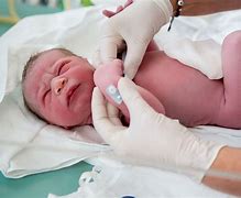 Image result for Baby Born Premature
