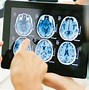 Image result for Types of Brain Disease