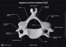 Image result for Cervical Vertebrae 6