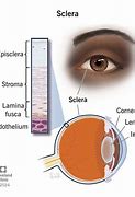 Image result for Sclera
