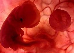 Image result for abortecer