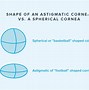 Image result for Contact Lens Toric Marking
