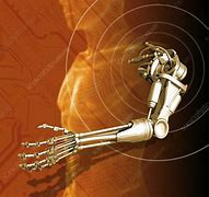 Image result for Robotic Arm Prosthetic