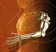Image result for Robotic Arm Prosthetic