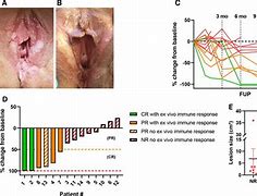 Image result for Genital Human Papillomavirus 16 and 18