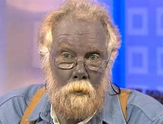 Image result for Ashy Skin White Person