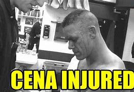 Image result for John Cena Elbow Injury