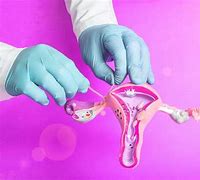 Image result for Hysterectomy