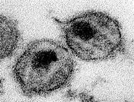 Image result for Genital Human Papillomavirus