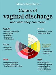Image result for What Does Pregnancy Discharge Look Like