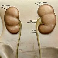 Image result for What Is a Large Cyst in the Kidney