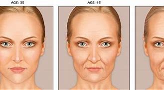 Image result for Aging Face Skin