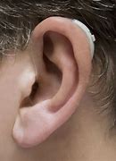 Image result for Micro Ear Hearing Aid