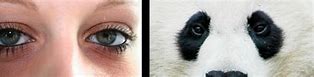 Image result for Panda Eyes People