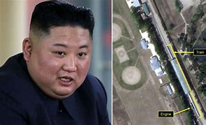 Image result for Kim Jong-un Health