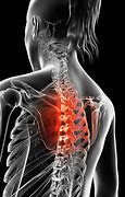 Image result for Thoracic Spine Nerve Pain