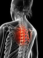 Image result for Thoracic Spine Pain Symptoms