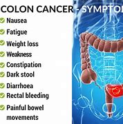 Image result for Colon Polyps Cancer Symptoms