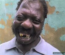 Image result for Funny Ugly Pictures with Theeth Out