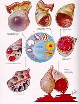 Image result for Cyst Sizes