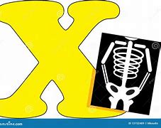 Image result for Letter X X-ray
