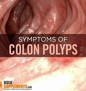 Image result for Benign Colon Polyps