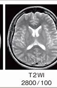 Image result for Hitachi CT Scan