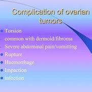 Image result for Ovarian Cyst Rupture
