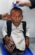 Image result for World Smallest Man in India