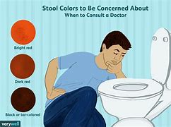Image result for Very Dark Brown Stool Color