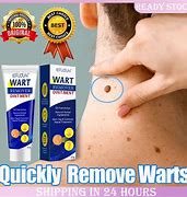 Image result for Armpit Wart Removal