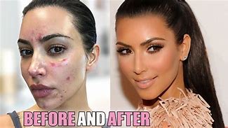 Image result for Kim K Skin Bleach