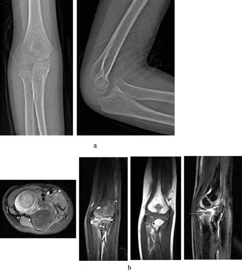 Image result for Example of Spatial Pattern Paragraph