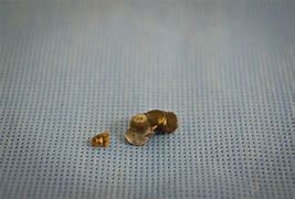 Image result for 1 mm Kidney Stone