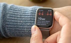 Image result for Apple Watch EKG Monitor