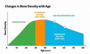 Image result for Overall Bone Density Chart