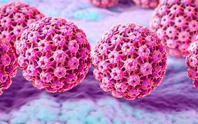 Image result for HPV Genital Warts