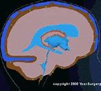 Image result for Galaxy Brain BGM