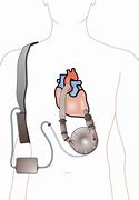 Image result for The Heart Is Not a Pump