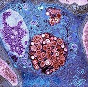 Image result for Chlamydia Bacteria Under Microscope