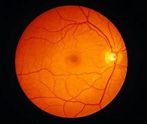 Image result for Retina Anatomy