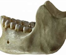 Image result for Human Jawbone