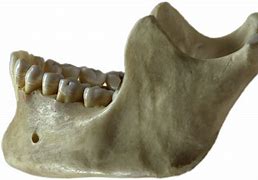 Image result for What Is Jawbone