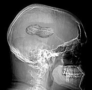 Image result for Peanut-Sized Brain