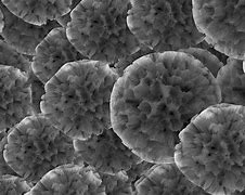 Image result for Activated Carbon Microscope