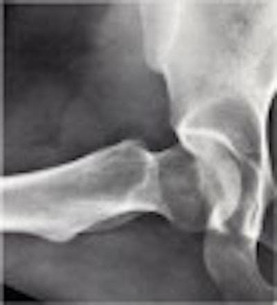 Image result for Open Frog Leg Position