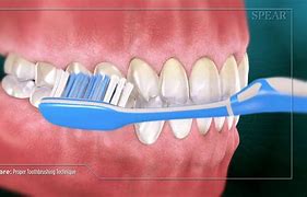 Image result for Toothbrush Technique
