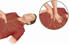 Image result for Correct Hand Placement for CPR